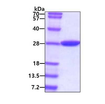 SDS-PAGE: Recombinant E. coli Carbonic Anhydrase II/CA2 His Protein [NBP3-18130]